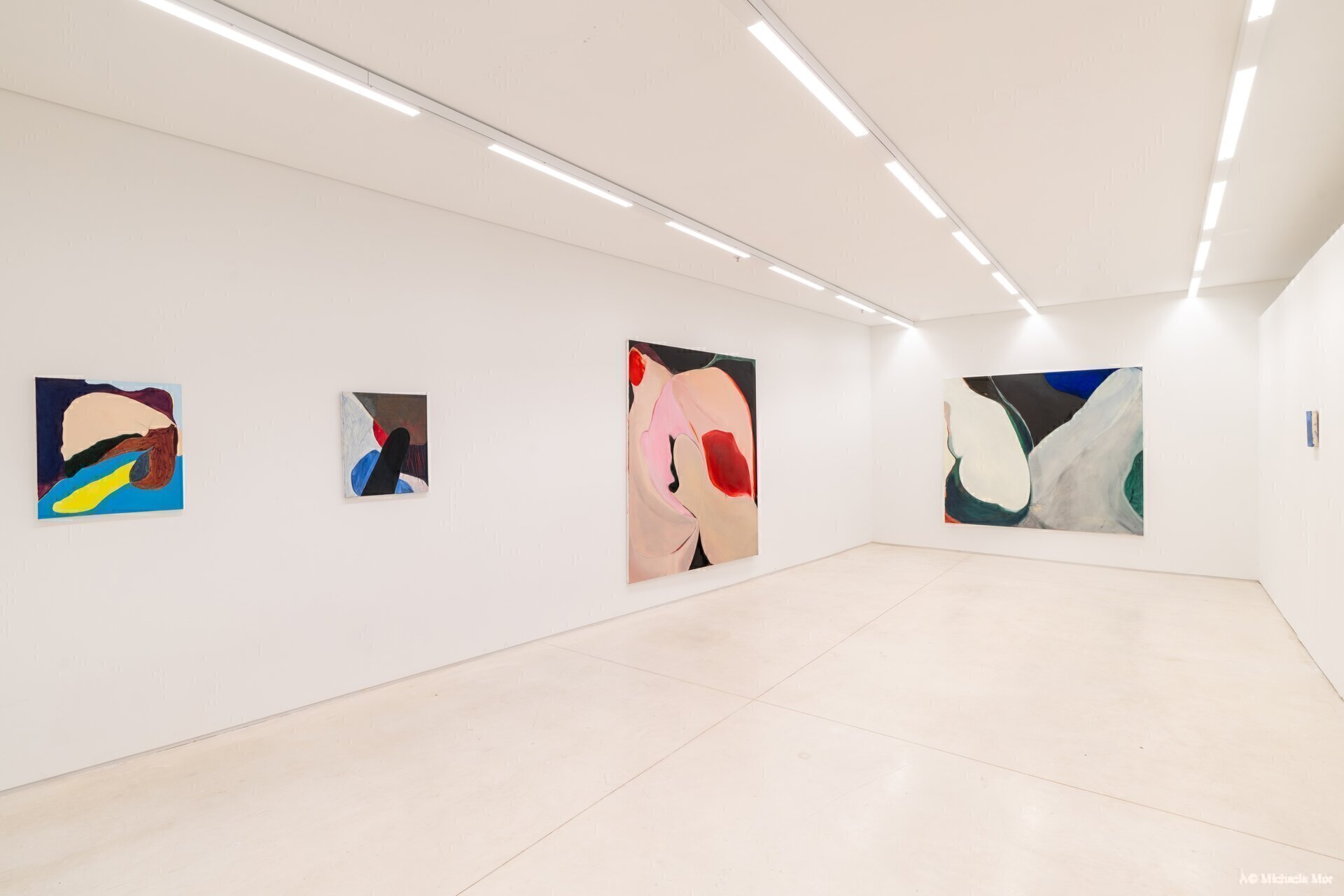 Nostalgia for the Present Body